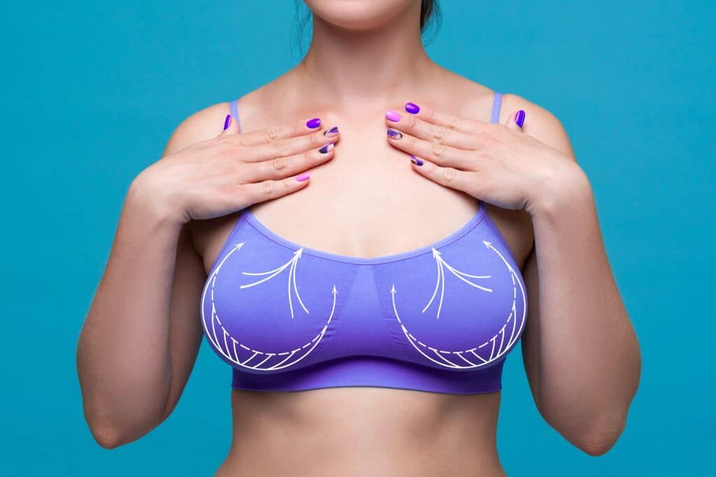 All You Need To Know About Your Breast Shape – Brastop US