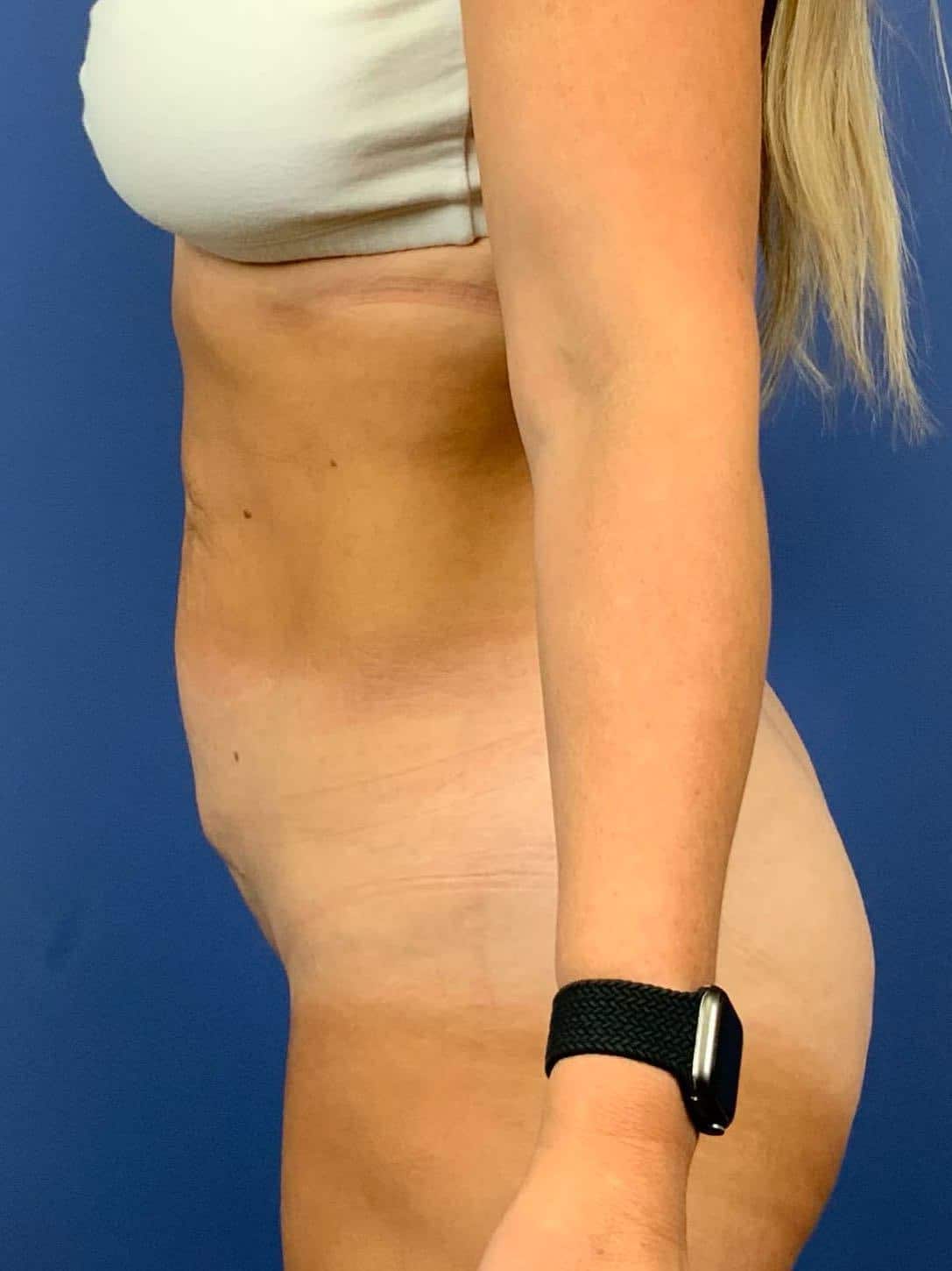 Before Image:  - left-side