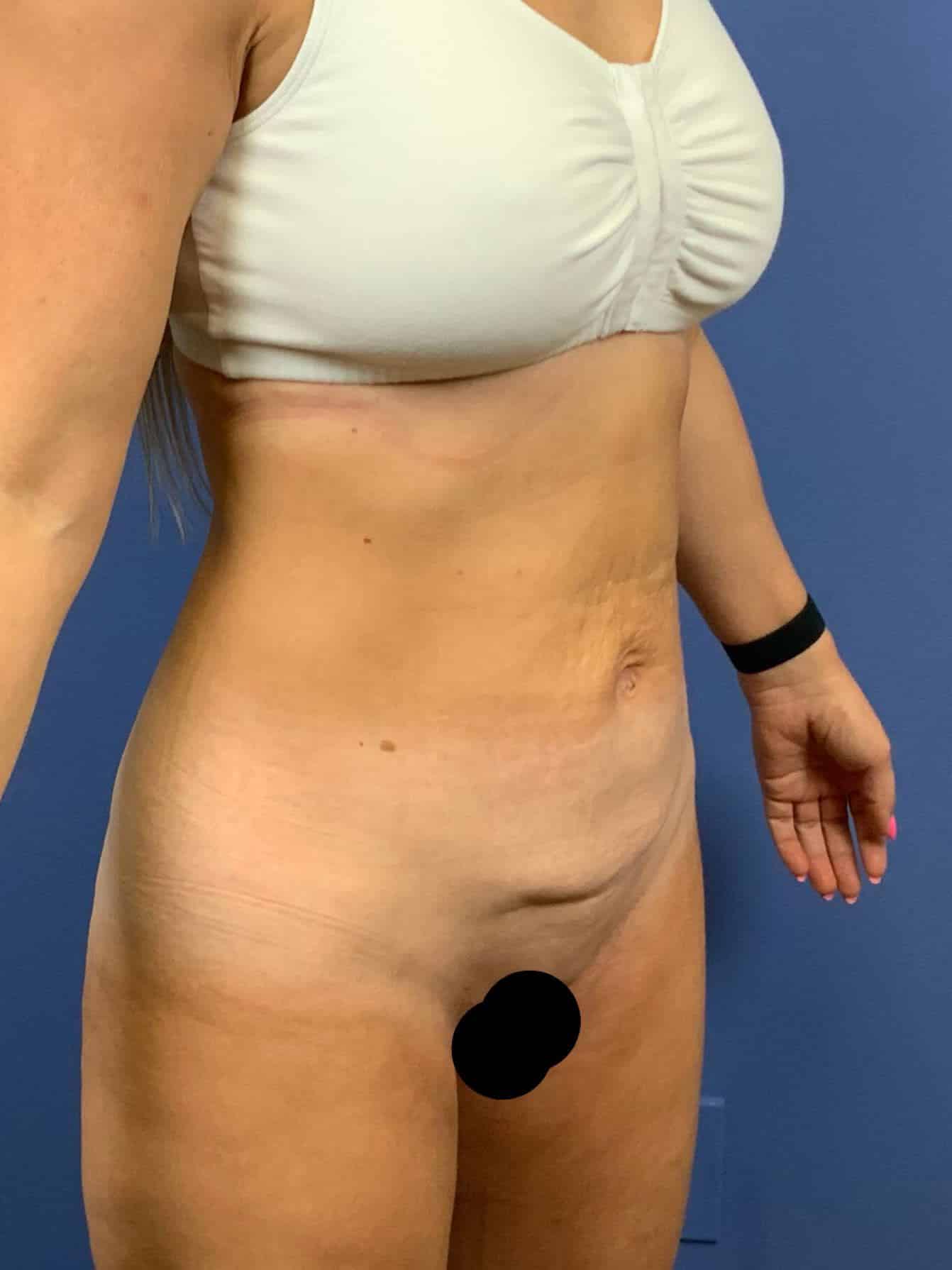 Before Image:  - right-front-oblique