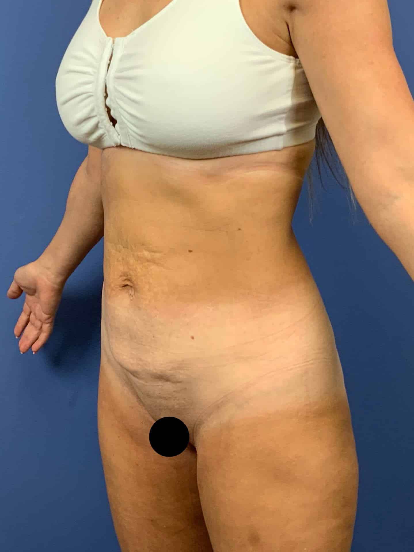 Before Image:  - left-front-oblique